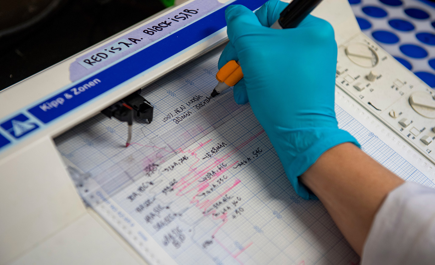 A gloved hand writes on a medical chart