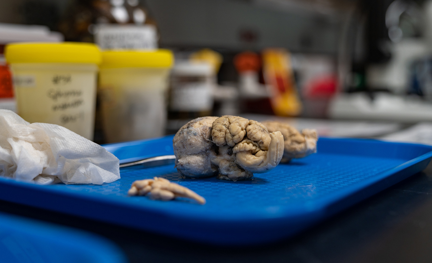 Organs on a tray