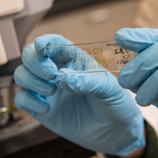 Sample Comparison in Lab